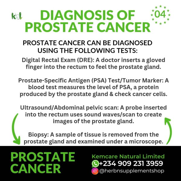 Prostate cancer 4